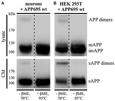 LRP1 Modulates APP Intraneuronal Transport and Processing in Its Monomeric and Dimeric State